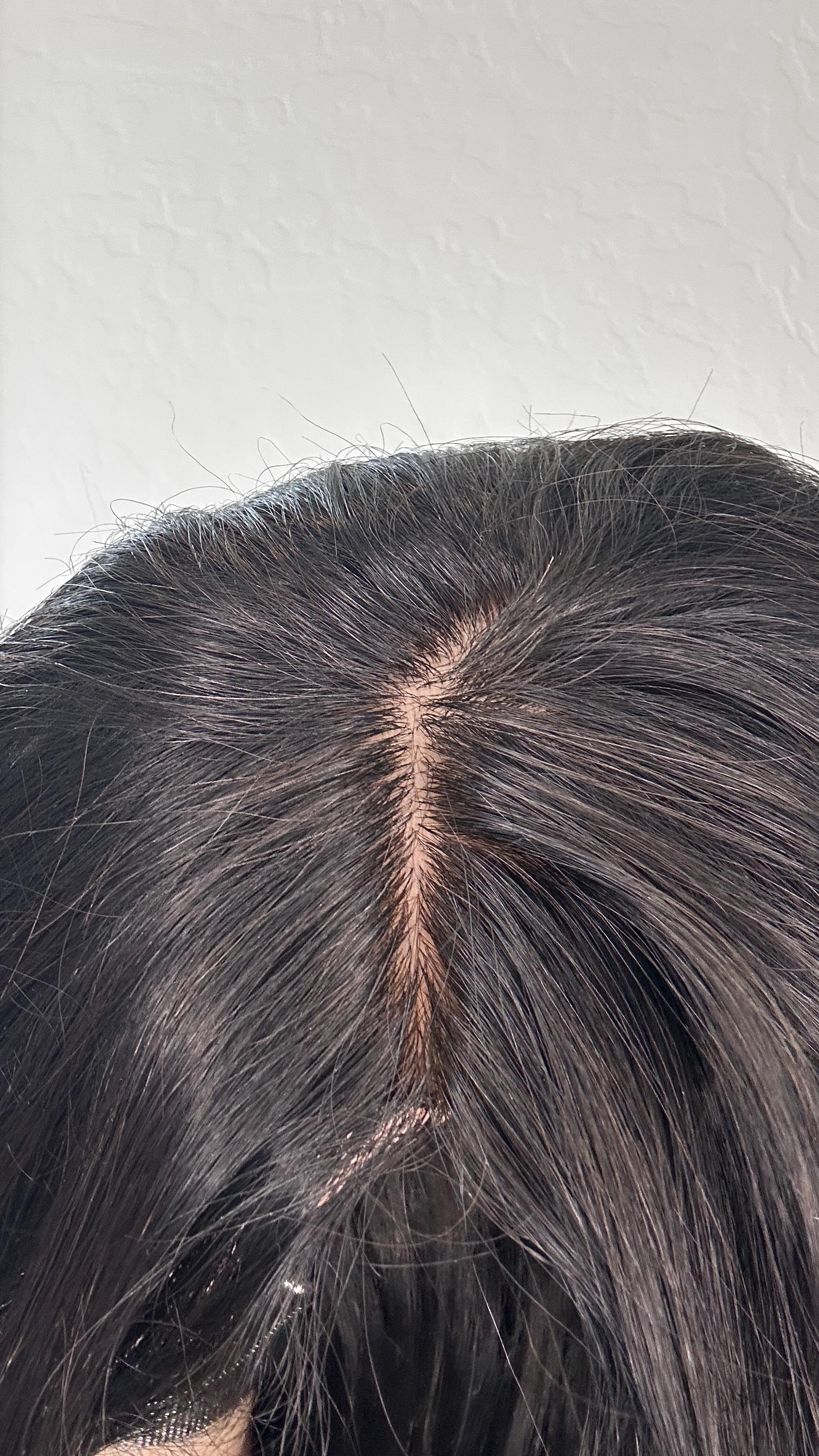 UNIQUE Custom-Made Custom virgin Human Hair Topper | High Density 170gm| HandTied | 20in Length |6x6 silk top Pear shape Natural Black