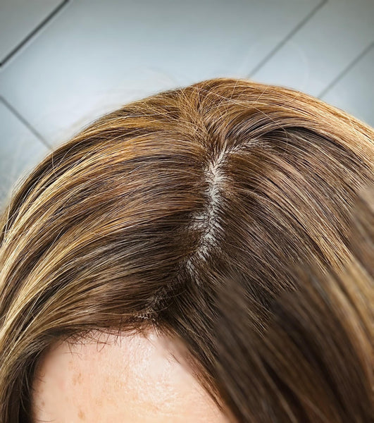 OLIVIA 14 Premium Remy Human Hair Topper w/Halo | 14” Skin Top | 7.5x7.5 Mid-Low Density | Warm Brunette with Golden Highlights Final Sale