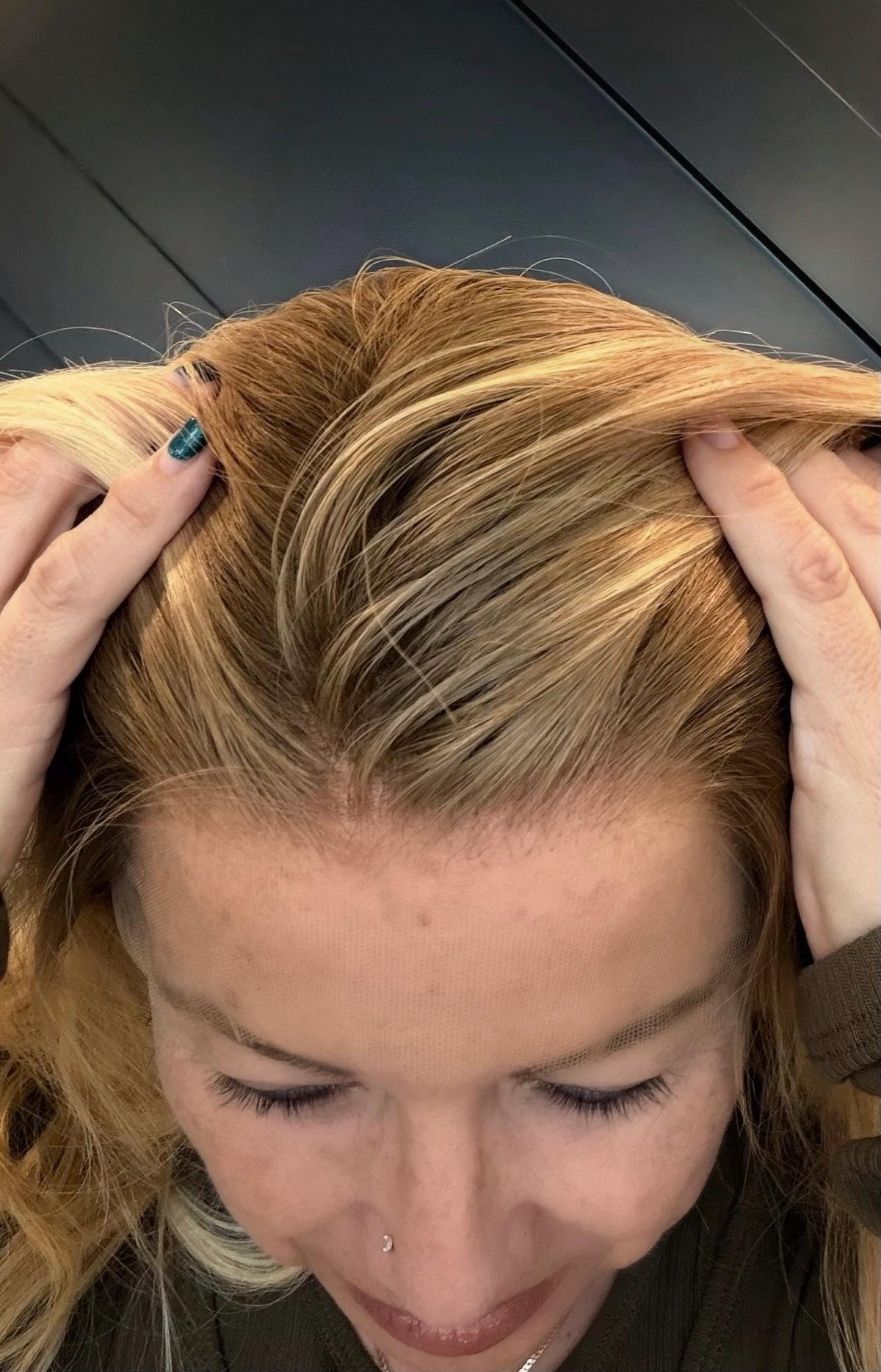 Human Hair Cranial Prosthesis HCPCS Code: A9282