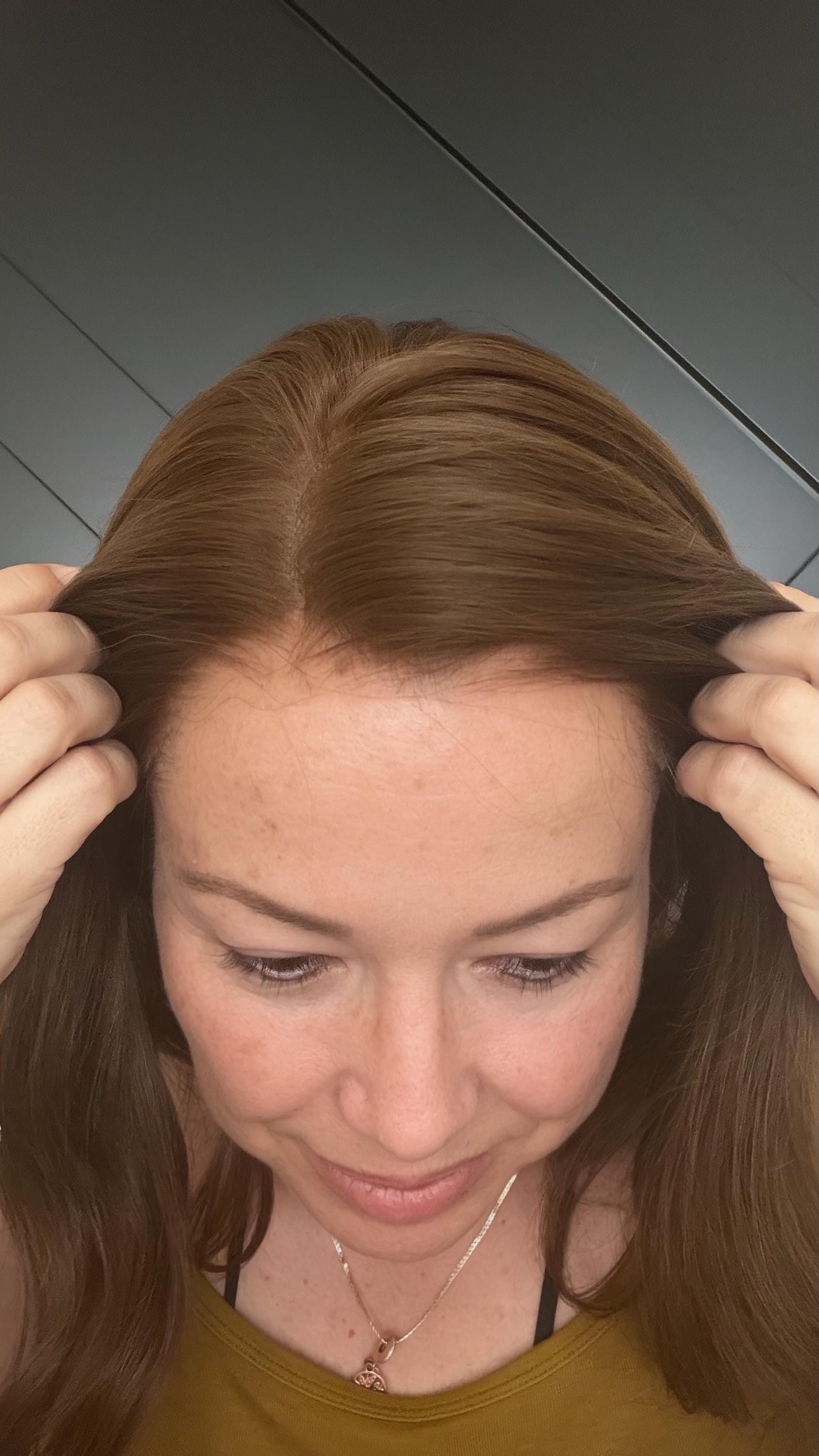 MONARK Brazilian Human Hair T-Crown T-Shaped Hairline Topper 2x11 + 4x6 deep base | Halo | Receding Hairline | Thinning Hair 10-16" t-lace